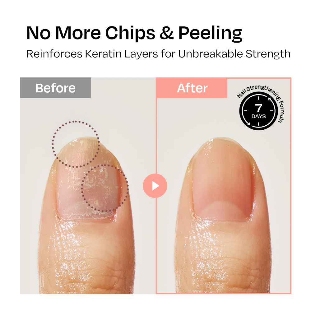 [Rosehip] Nail Strengthener - Image 5